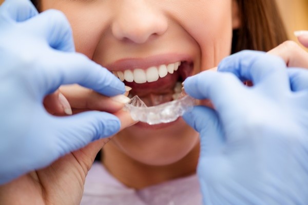 Invisalign Can Be Convenient For Common Teeth Straightening Needs